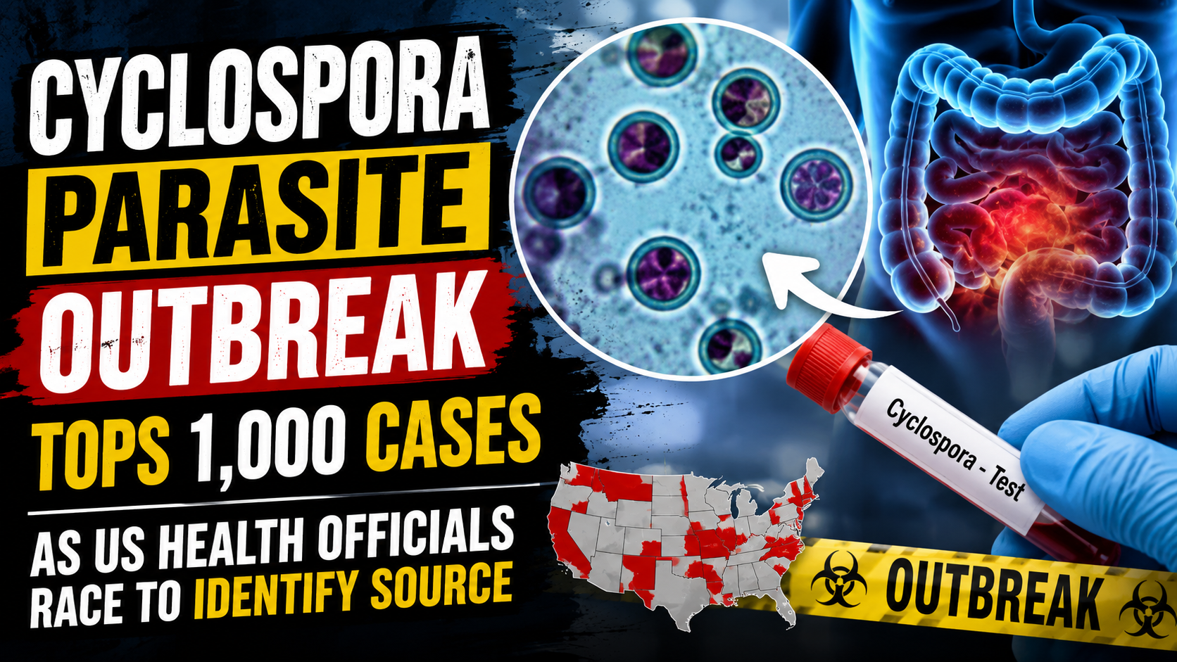 cyclospora parasite outbreak